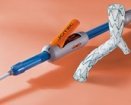Jotec E-liac Stent Graft System | Which Medical Device